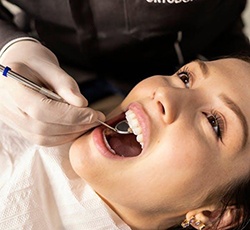 Dental mirror in woman’s mouth